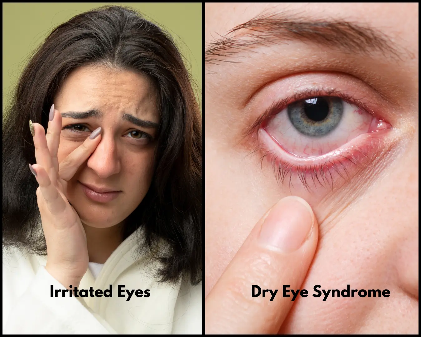 Advanced Dry Eye Treatments in Idaho Falls